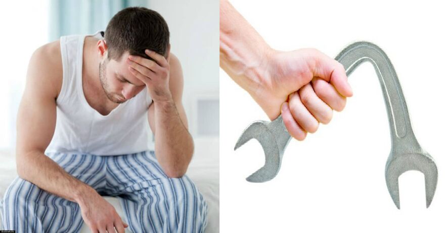 Prostatitis Symptome